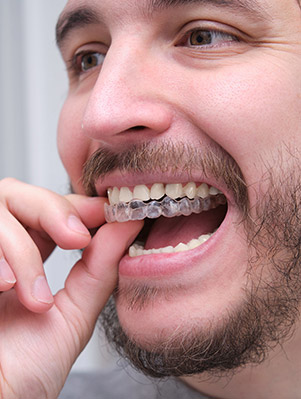 invisalign costs